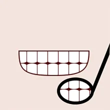 口腔检查与洁牙